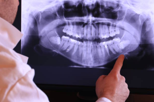 Best Cosmetic Emergency Dentistry in Morgan City, LA