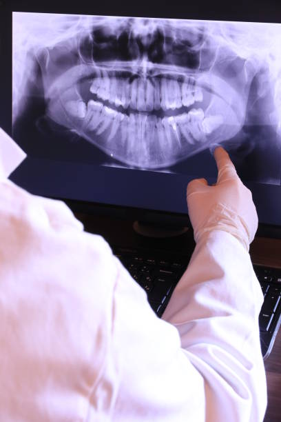 Best Emergency Gum Treatment in Morgan City, LA